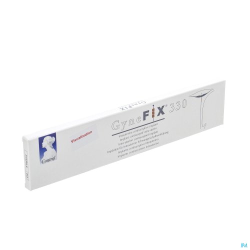 GYNEFIX 330 IUD GYNEFIX 330 IUD